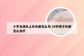 十岁女孩头上长头癣怎么为 10岁孩子头癣怎么治疗