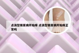 点滴型银屑病开始痒 点滴型银屑病开始痒正常吗