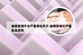 副银屑病不太严重用吃药不 副银屑病不严重能自愈吗