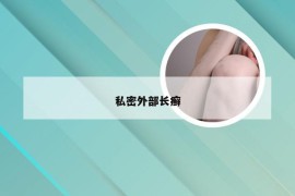 私密外部长癣