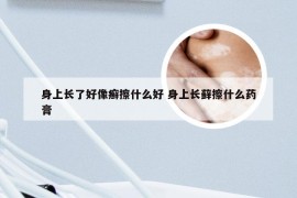 身上长了好像癣擦什么好 身上长藓擦什么药膏