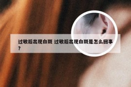 过敏后出现白斑 过敏后出现白斑是怎么回事?