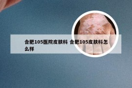 合肥105医院皮肤科 合肥105皮肤科怎么样