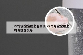 22个月宝宝脸上有白斑 22个月宝宝脸上有白斑怎么办