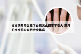 宝宝满月后出现了白班怎么回事不变大 满月的宝宝很白以后会变黑吗