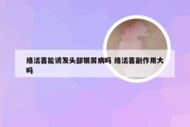 络活喜能诱发头部银屑病吗 络活喜副作用大吗