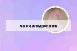 牛皮癣可以打新冠肺炎疫苗嘛