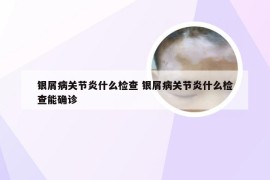 银屑病关节炎什么检查 银屑病关节炎什么检查能确诊