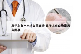 鼻子上有一小块白很光滑 鼻子上有白块是怎么回事