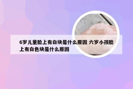 6岁儿童脸上有白块是什么原因 六岁小孩脸上有白色块是什么原因