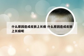 什么原因造成皮肤上长癣 什么原因造成皮肤上长癣呢