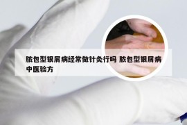 脓包型银屑病经常做针灸行吗 脓包型银屑病中医验方