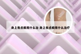 身上有点癣用什么治 身上有点癣用什么治疗