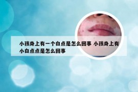 小孩身上有一个白点是怎么回事 小孩身上有小白点点是怎么回事