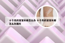 十个月的宝宝长癣怎么办 十个月的宝宝长癣怎么办图片