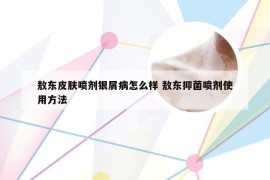 敖东皮肤喷剂银屑病怎么样 敖东抑菌喷剂使用方法