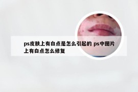 ps皮肤上有白点是怎么引起的 ps中图片上有白点怎么修复