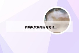 白癜风发展期治疗方法