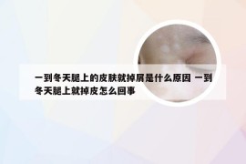 一到冬天腿上的皮肤就掉屑是什么原因 一到冬天腿上就掉皮怎么回事