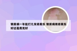 银屑病一年能打几支修美乐 银屑病用修美乐好还是类克好