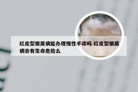 红皮型银屑病能办理慢性手读吗 红皮型银屑病会有生命危险么