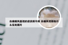 白癞癜风最初的症状痒不痒 白癞风初期有什么征兆图片