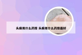 头癣用什么药擦 头癣用什么药擦最好