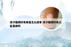 孩子胳膊肘有癣是怎么回事 孩子胳膊肘有凸起是癣吗