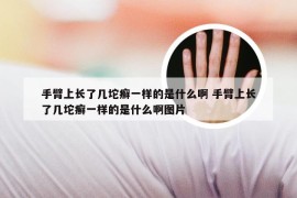 手臂上长了几坨癣一样的是什么啊 手臂上长了几坨癣一样的是什么啊图片