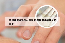 脸部银屑病涂什么药膏 脸部银屑病擦什么药膏好