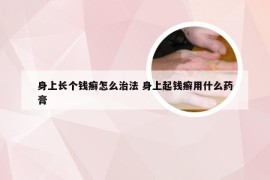 身上长个钱癣怎么治法 身上起钱癣用什么药膏