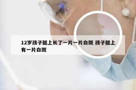 12岁孩子腿上长了一片一片白斑 孩子腿上有一片白斑