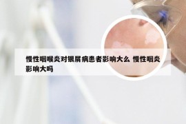 慢性咽喉炎对银屑病患者影响大么 慢性咽炎影响大吗