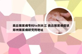 商丘银屑病专科to刘长江 商丘银屑病症状郑州银屑病研究院地址