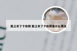 脸上长了个白斑 脸上长了个白斑是什么情况