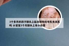 3个多月的孩子额头上起白斑和吃母乳有关系吗 小宝宝3个月额头上有小白斑