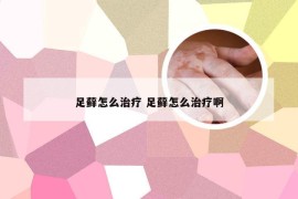 足藓怎么治疗 足藓怎么治疗啊