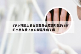 8岁小孩脸上长白斑是什么原因引起的 8岁的小朋友脸上有白斑是生病了吗