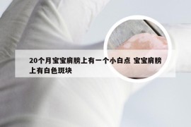 20个月宝宝肩膀上有一个小白点 宝宝肩膀上有白色斑块