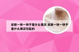 皮肤一块一块干是什么情况 皮肤一块一块干是什么情况引起的