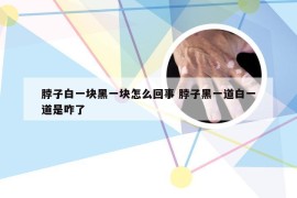 脖子白一块黑一块怎么回事 脖子黑一道白一道是咋了