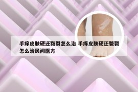 手痒皮肤硬还皲裂怎么治 手痒皮肤硬还皲裂怎么治民间医方