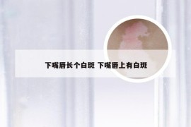 下嘴唇长个白斑 下嘴唇上有白斑