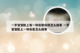 一岁宝宝脸上有一块皮肤白斑怎么回事 一岁宝宝脸上一块白色怎么回事