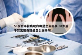 50岁后手臂出现白斑是怎么回事 50岁后手臂出现白斑是怎么回事呢