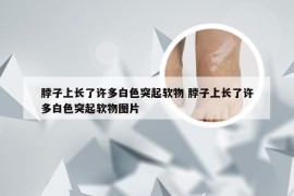 脖子上长了许多白色突起软物 脖子上长了许多白色突起软物图片