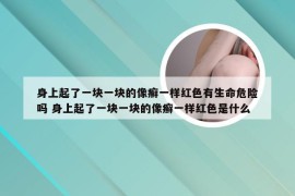 身上起了一块一块的像癣一样红色有生命危险吗 身上起了一块一块的像癣一样红色是什么