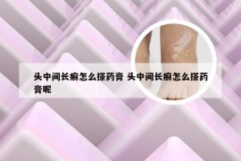 头中间长癣怎么搽药膏 头中间长癣怎么搽药膏呢