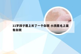 11岁孩子眉上长了一个白斑 小孩眉毛上面有白斑