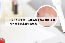 15个月宝宝腿上一块块发白怎么回事 十五个月宝宝腿上有小红点点